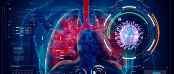 AI tool predicts which coronavirus patients get deadly 'wet lung'