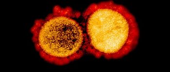 5,700 COVID-19 testing backlog at RITM due to staff quarantine, broken equipment — DOH